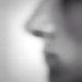 Rhinoplasty 
