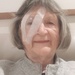 Cataracts