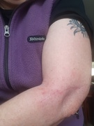 21st Aug 2025 - Burn