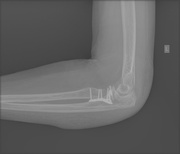 13th Apr 2026 - x-rays