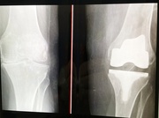 23rd Apr 2026 - Before and after.......