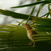 Thrush in the Bush